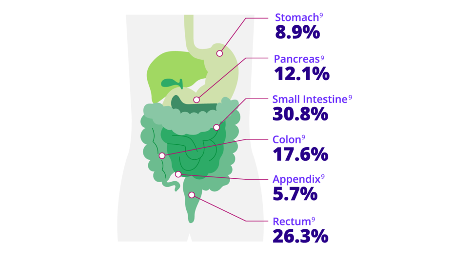 Diagram pointing out the location and incidence of the primary sites of GEP-NETs in the human body. The small intestine was the most commonly involved site (30.8%), followed by the rectum (26.3%), colon (17.6%), pancreas (12.1%), stomach (8.9%), and appendix (5.7%)